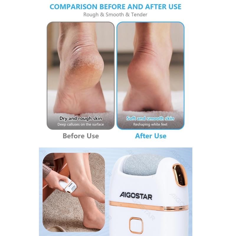 RIMUOVI CALLI PROFESSIONALE ELETTRICO AIGOSTAR 4W CON 2 TESTINE DI RICAMBIO - immagine 4